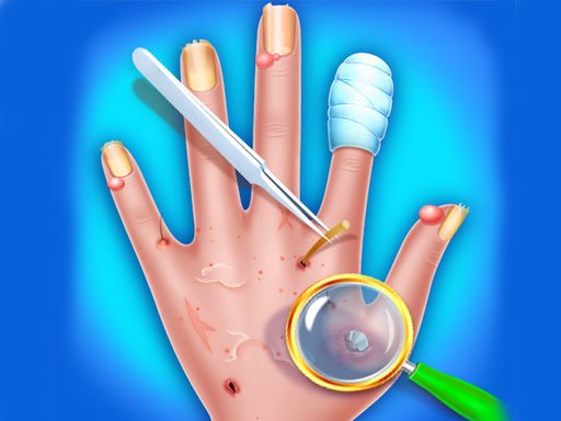Hand Skin Doctor - Hospital Game - 手皮肤医生 - 医院游戏